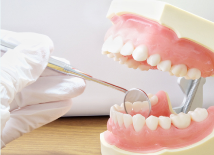 歯周内科による歯周病治療